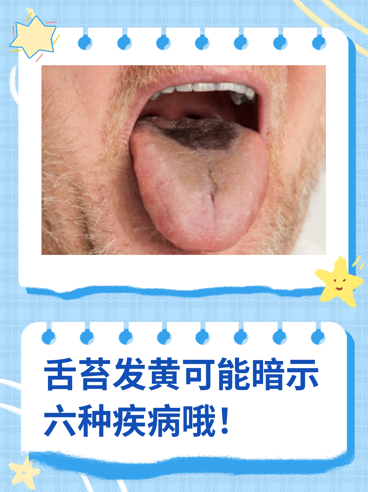 舌苔黄厚口臭怎么办