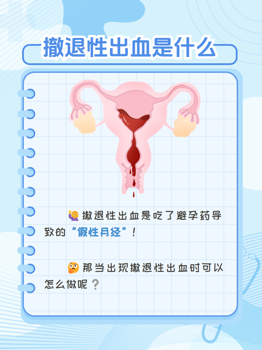 撤退性出血避孕成功了吗?