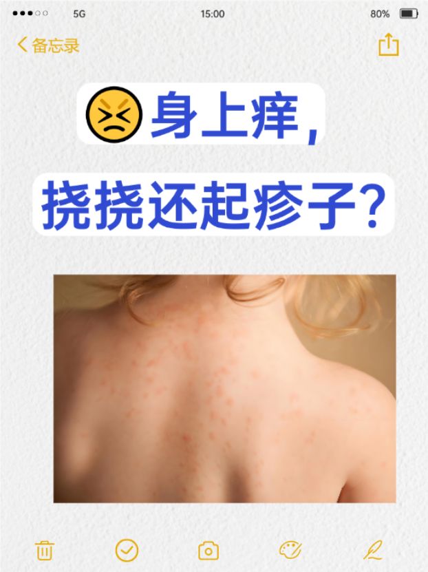 一热身体就像针扎一样痒