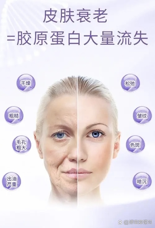 如何补充胶原蛋白