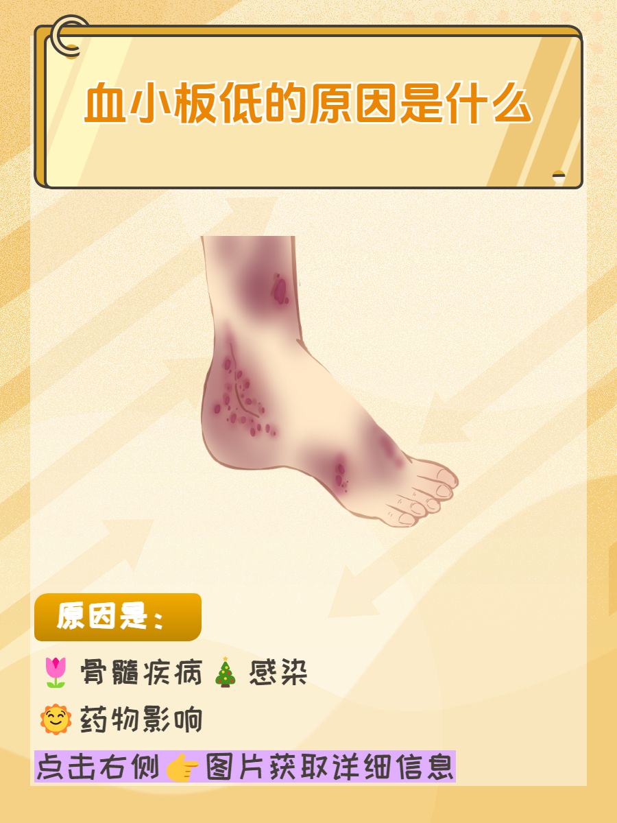 血小板低有哪些症状