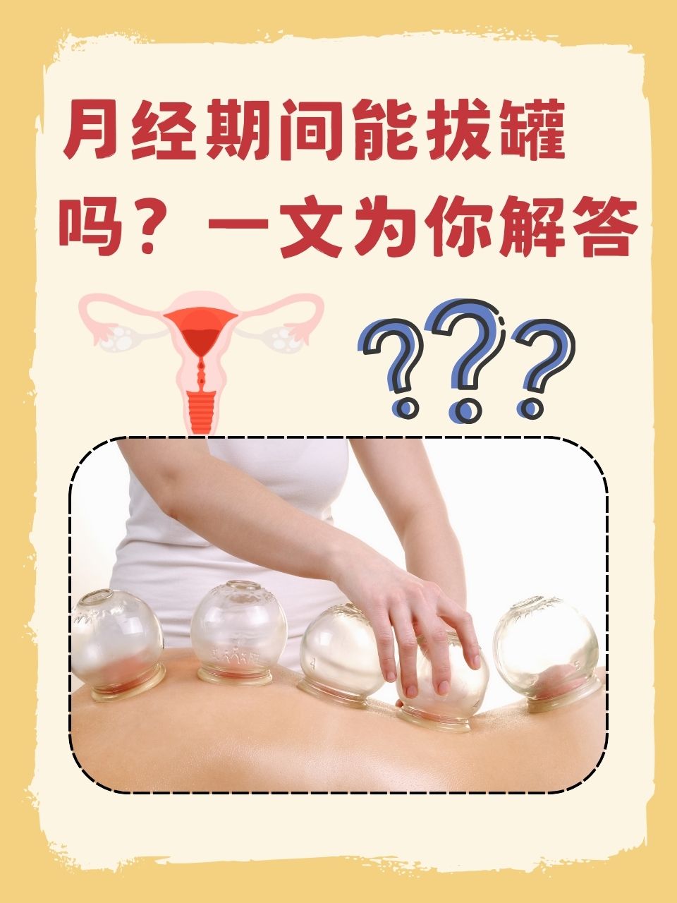 拔血罐有科学根据吗