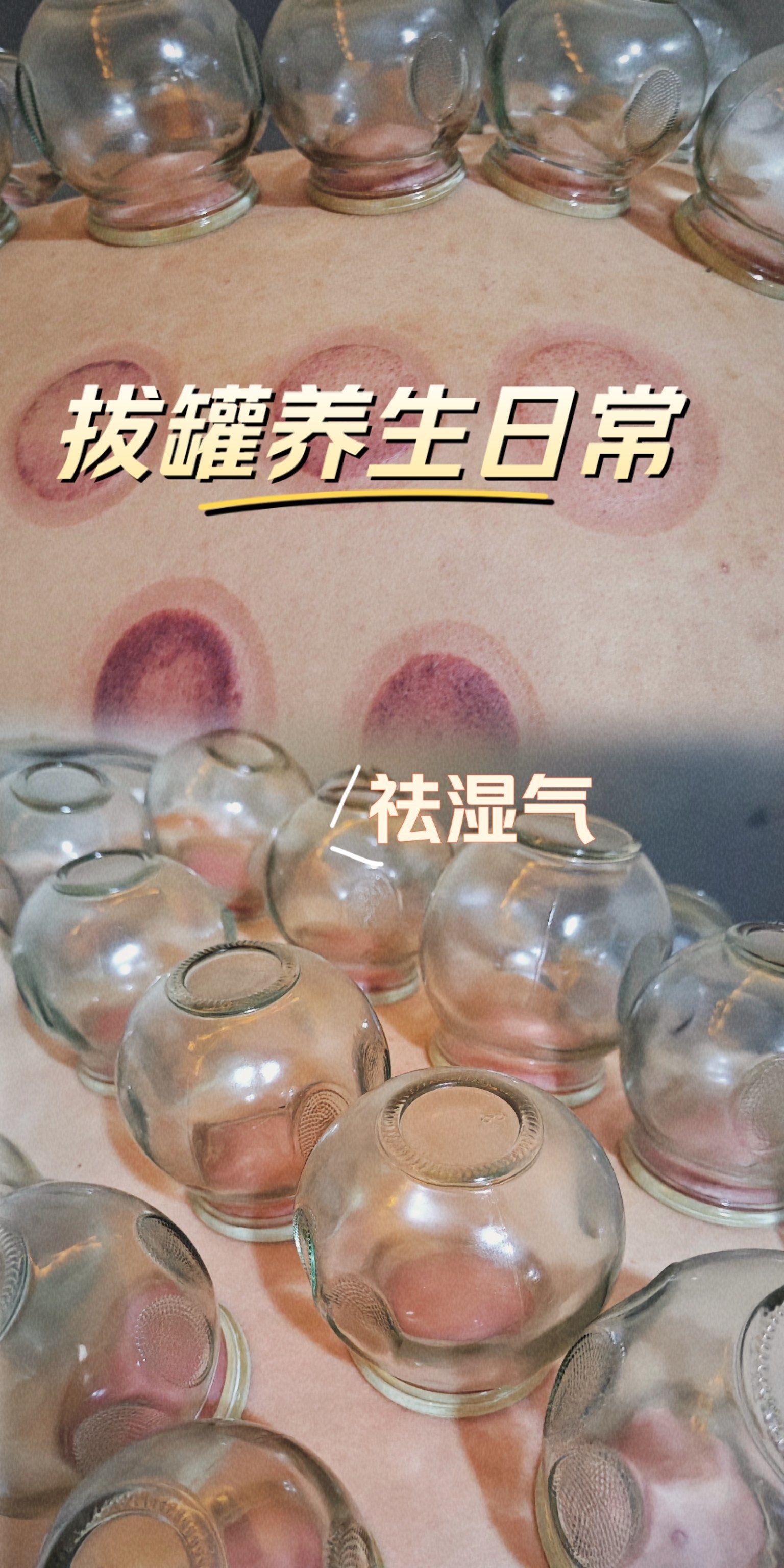 拔血罐有科学根据吗