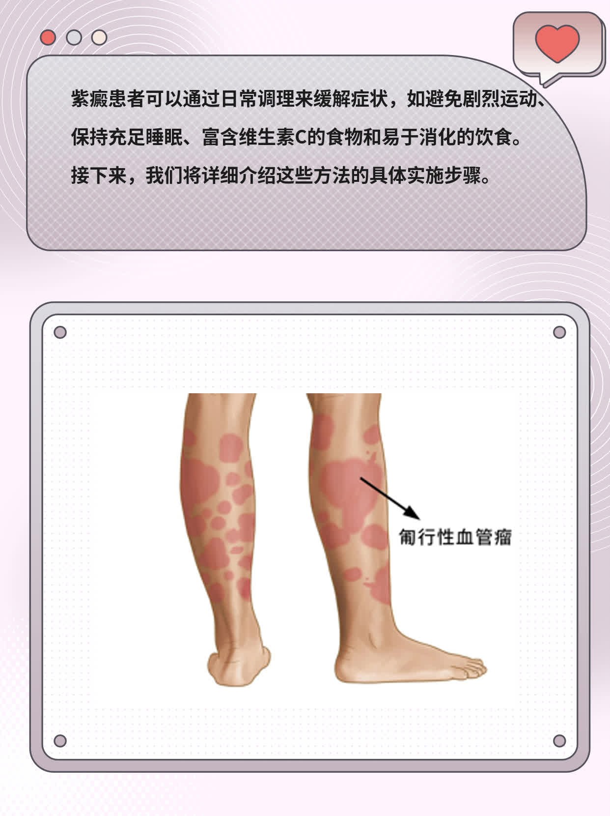 血小板低的症状有哪些?