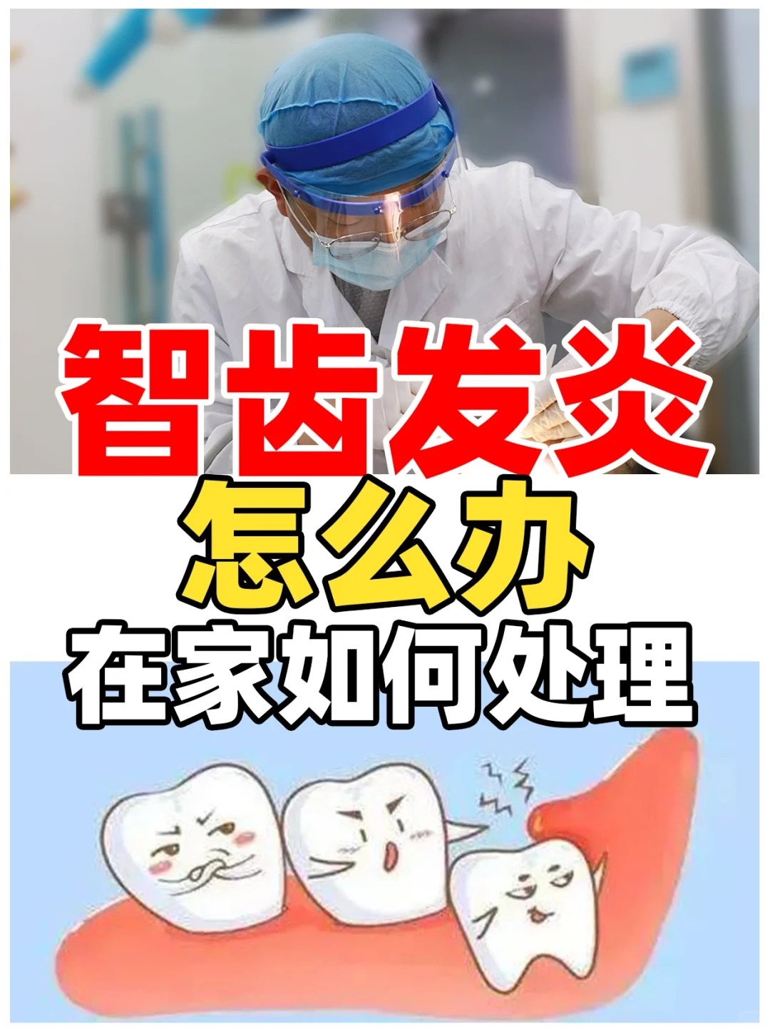 智齿发炎发红几天能好