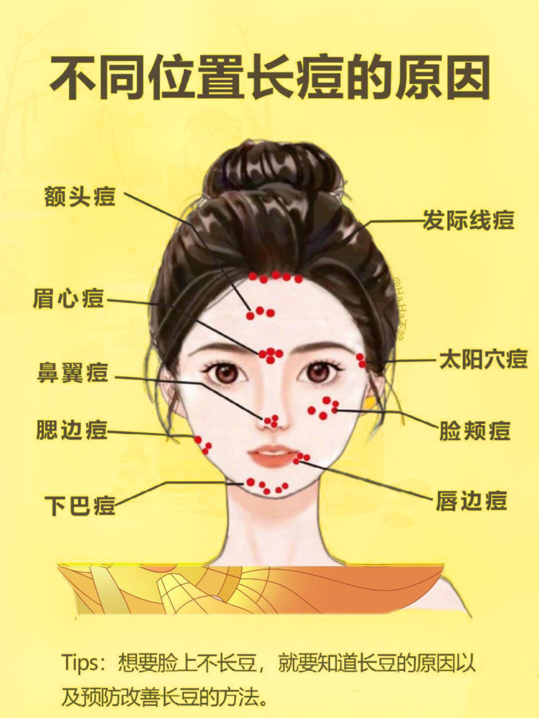 额头长痘痘原因