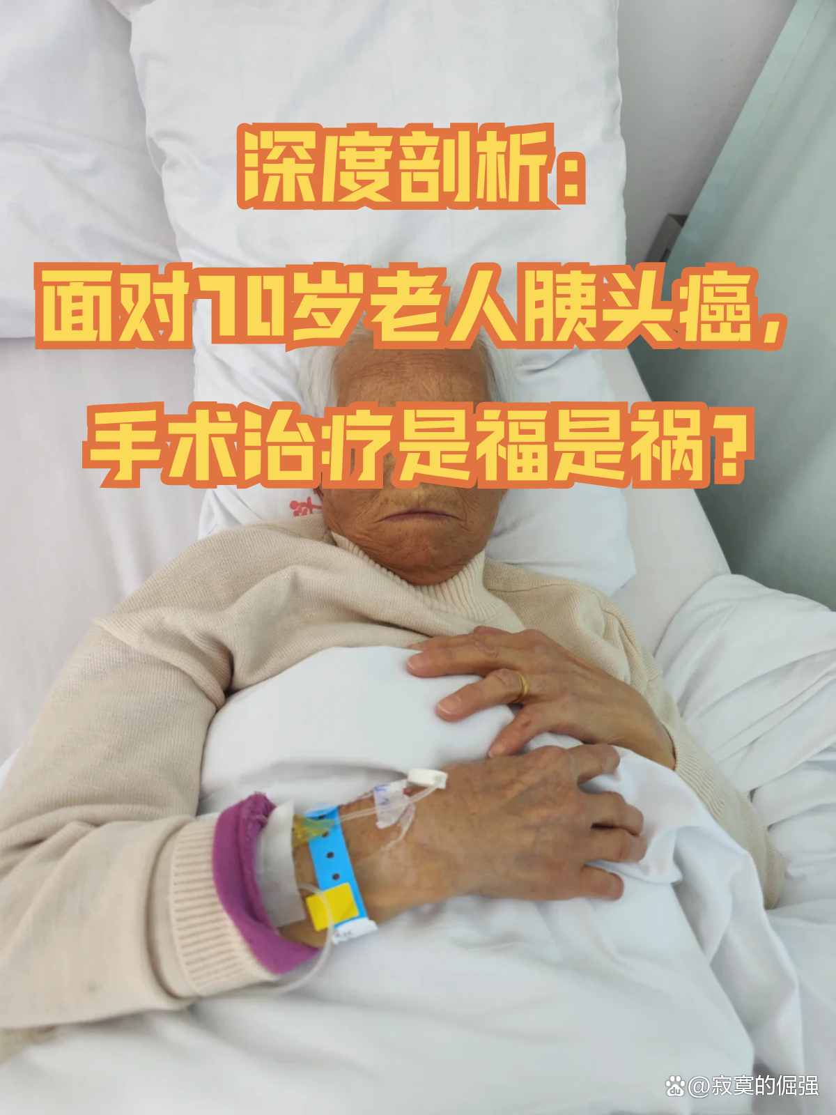 胰腺癌晚期怎么治?