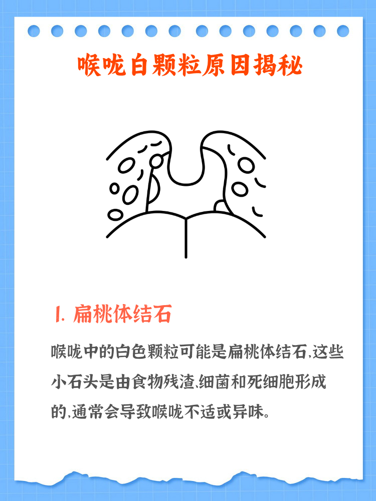 咽部异物感怎么消除