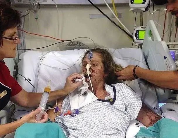 截肢手术需要多少费用?