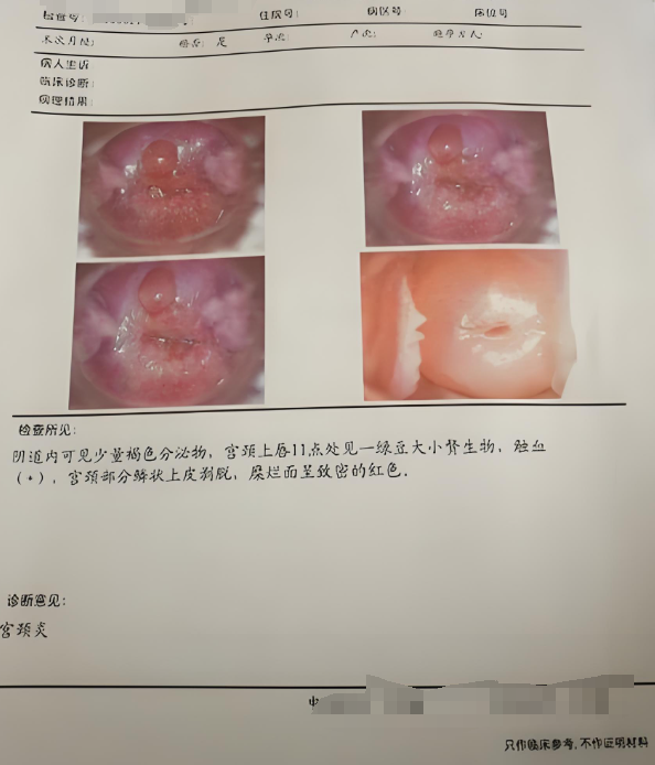 为什么白带发黄