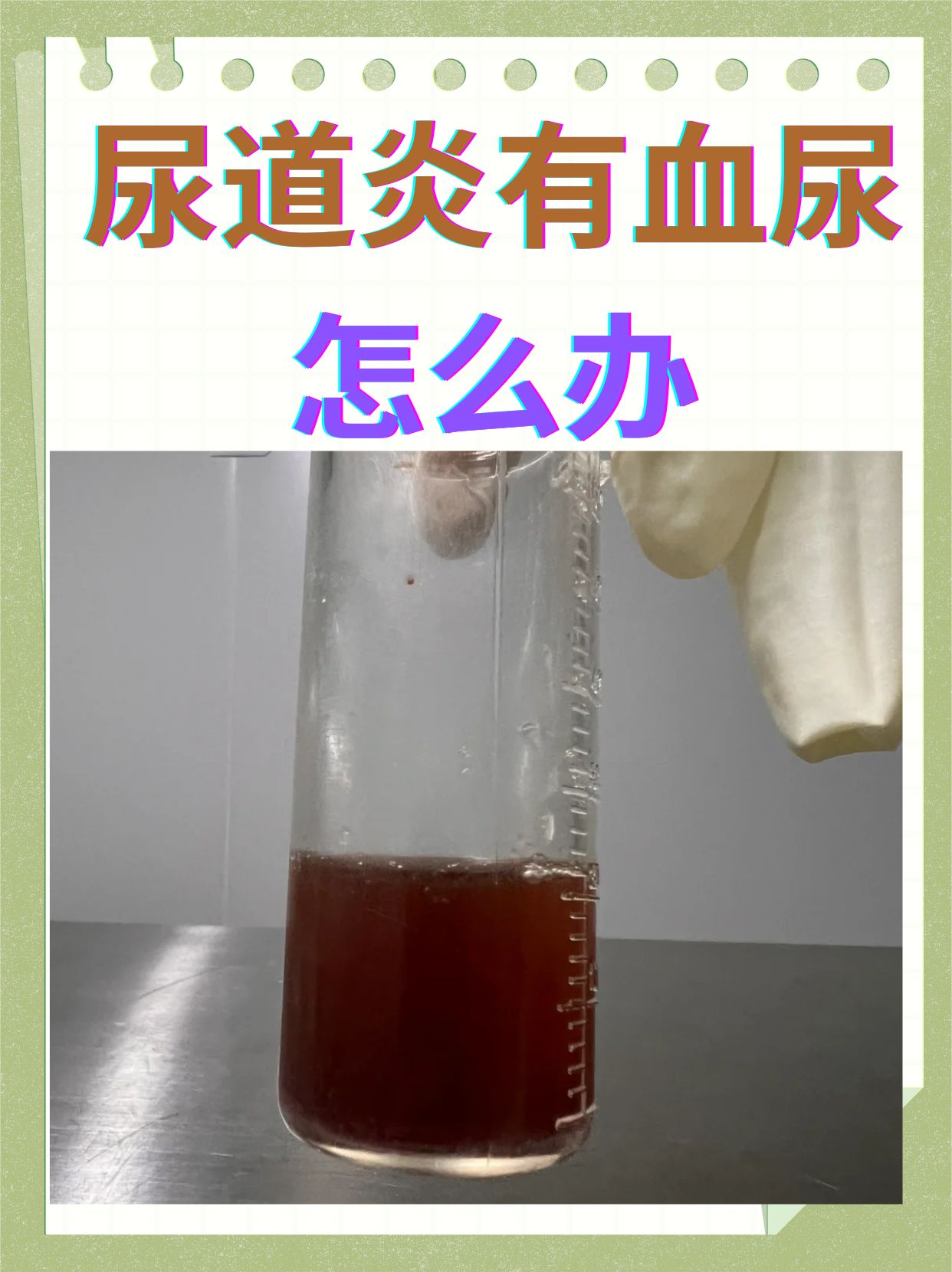 尿出血是怎么了?