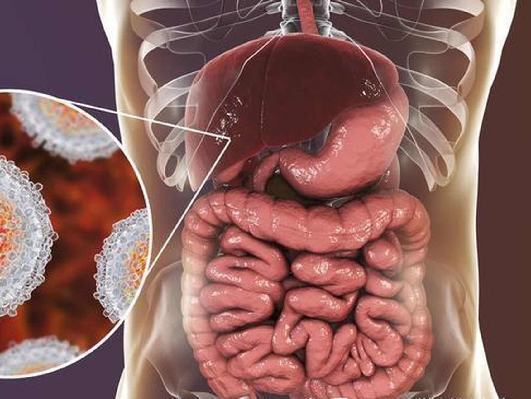 结肠癌的早期症状及表现