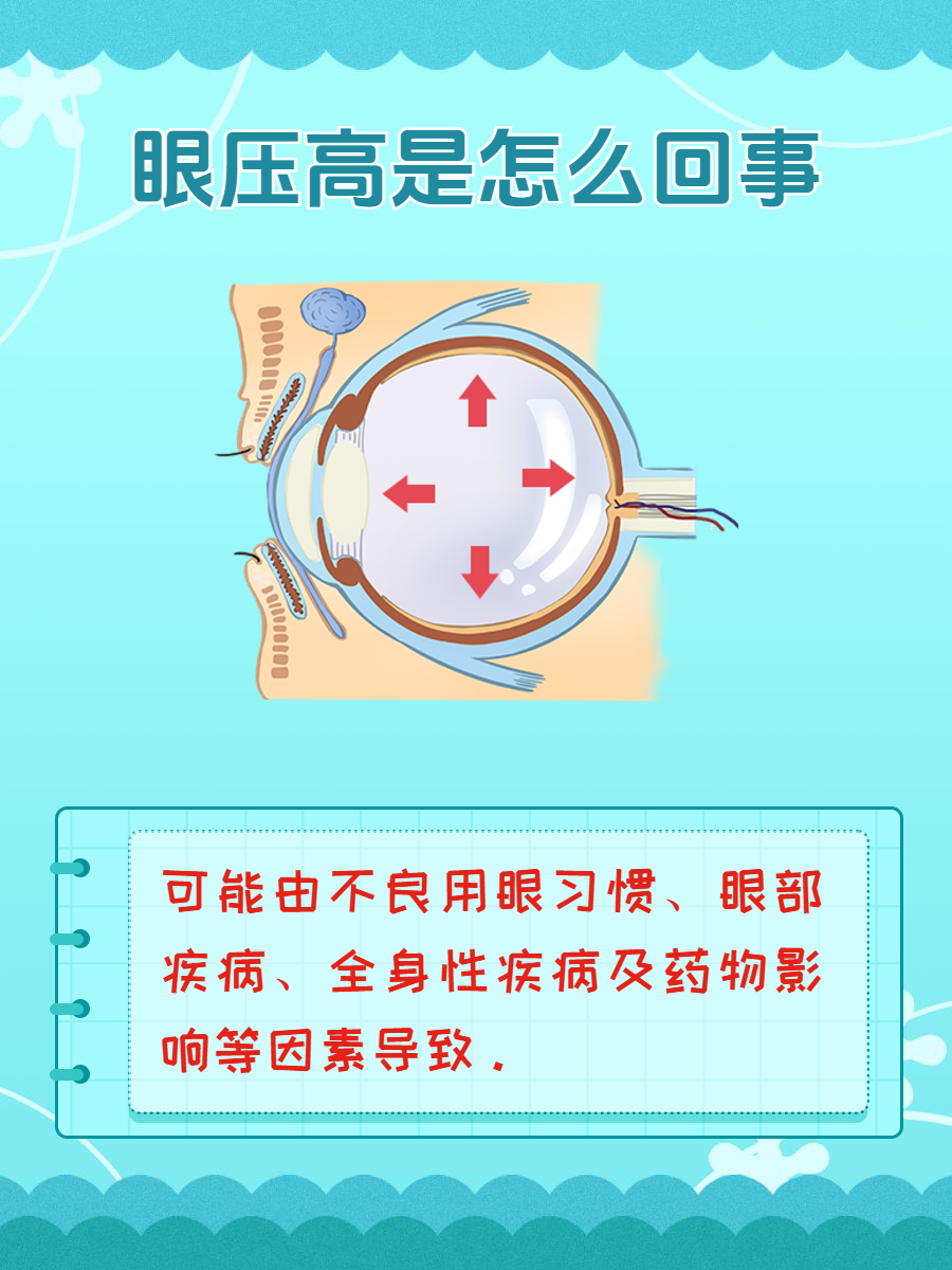 眼压高如何缓解