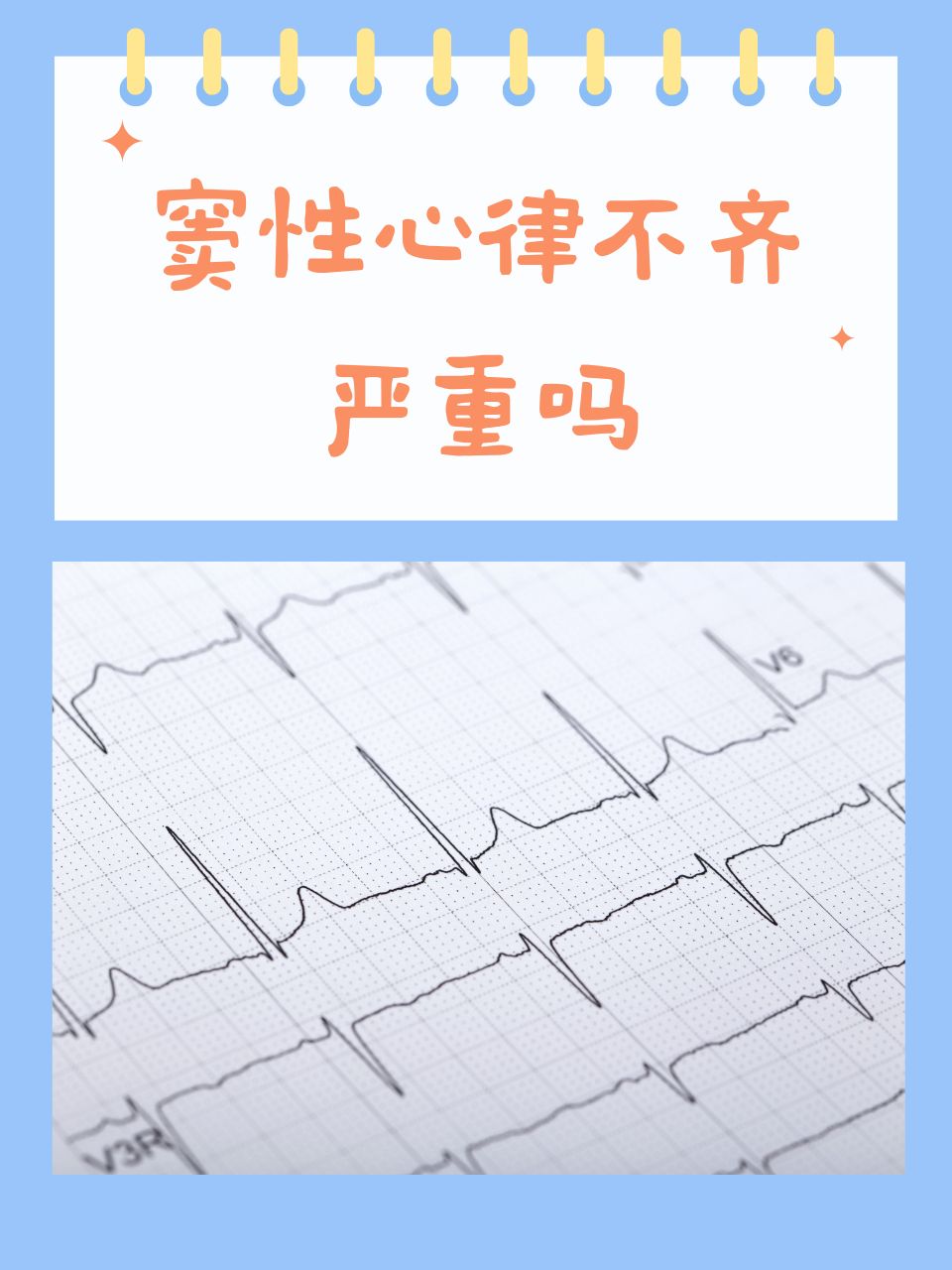 窦性心律是病吗