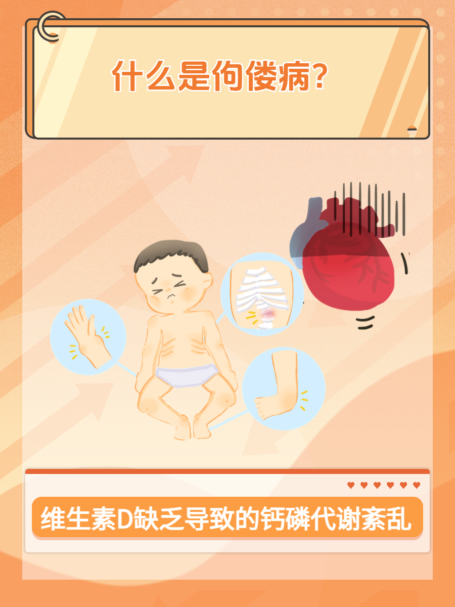 佝偻病是什么病