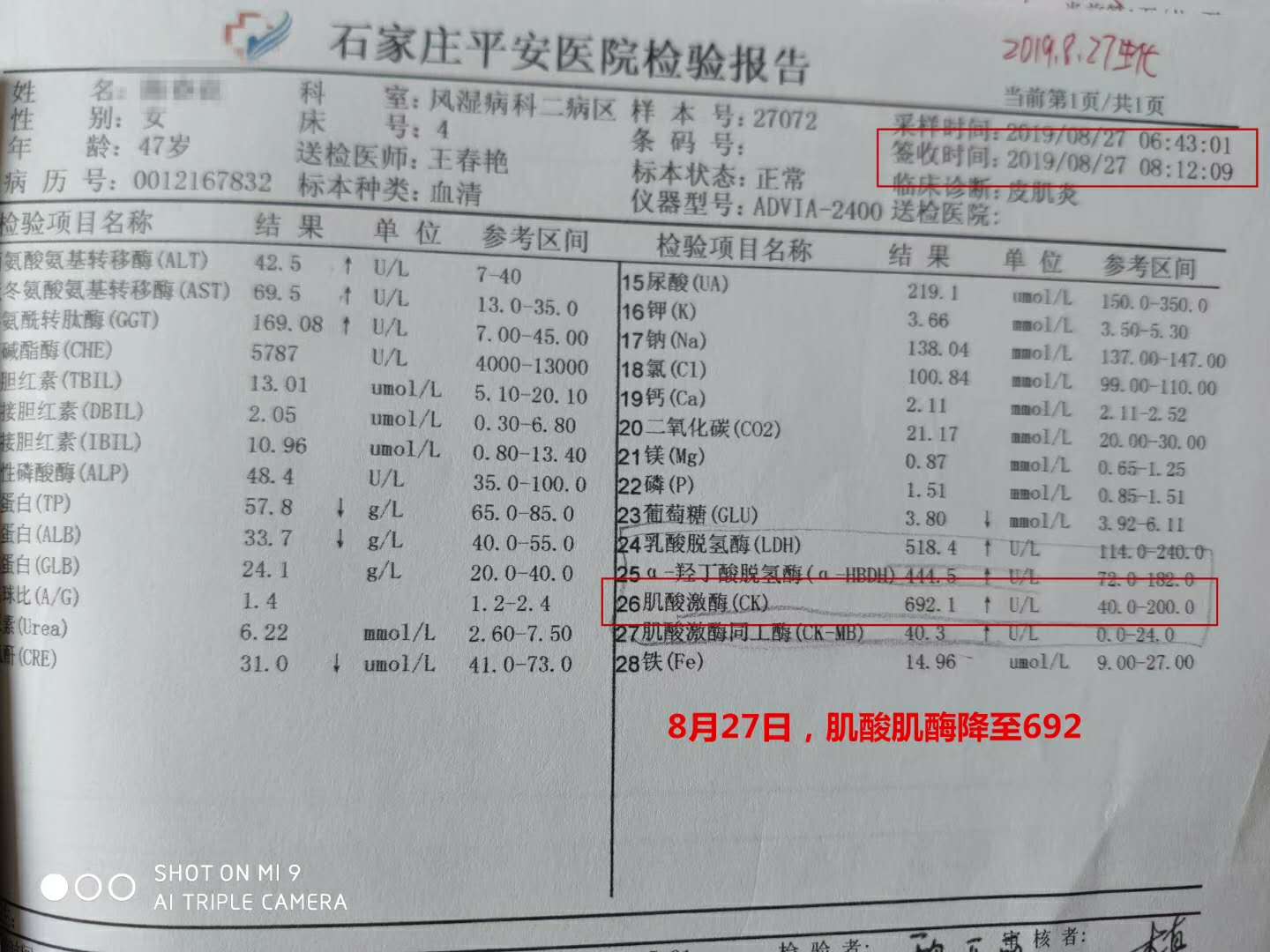 肌酸激酶高是怎么回事