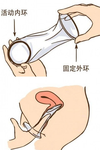 真人演示女用避孕套视频