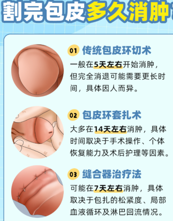 包皮水肿如何快速消肿