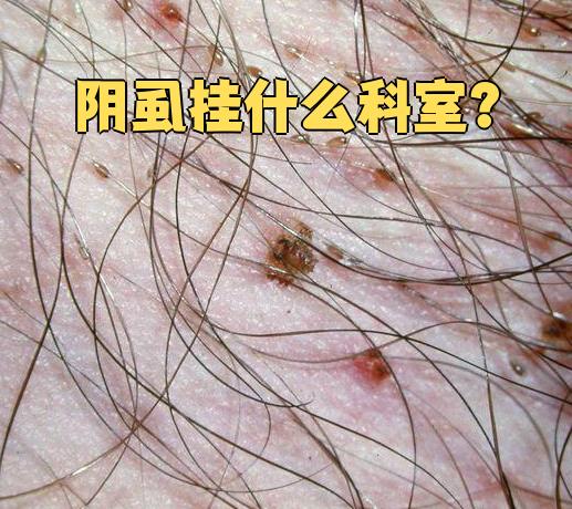 阴虱有什么症状