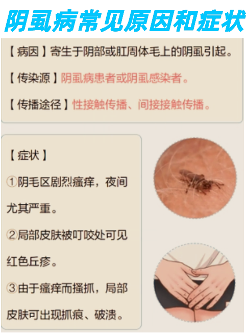 阴虱有什么症状