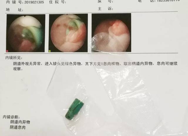 阴道出血了是怎么回事