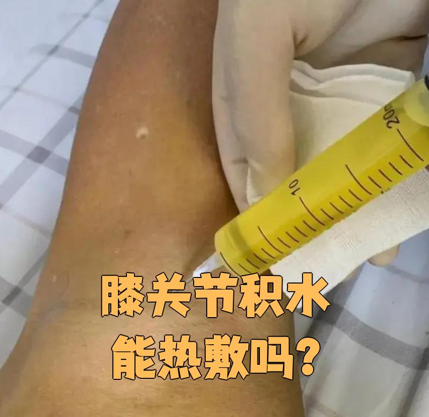 滑膜炎有积液怎么办