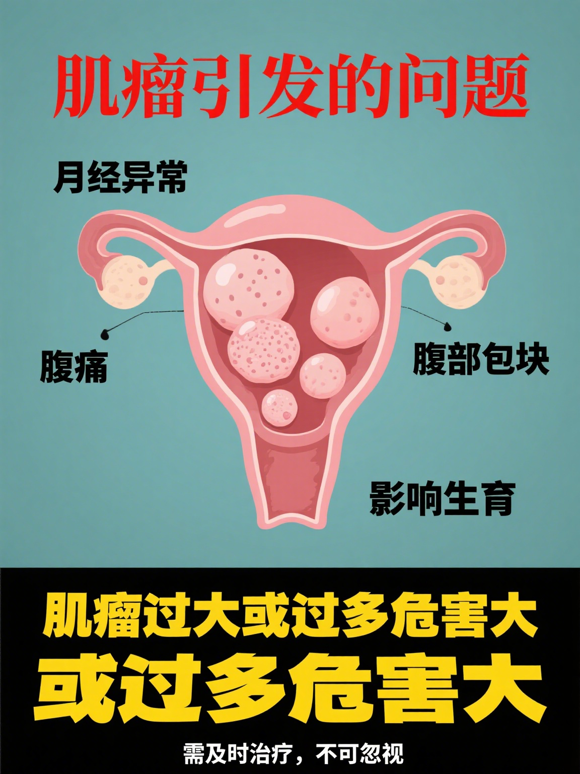 子宫肌瘤很严重吗