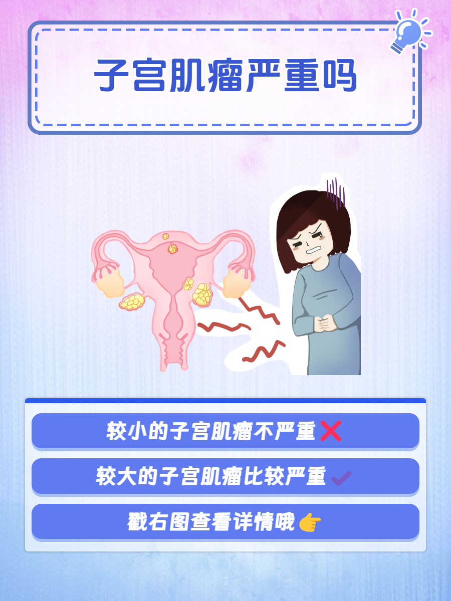 子宫肌瘤很严重吗
