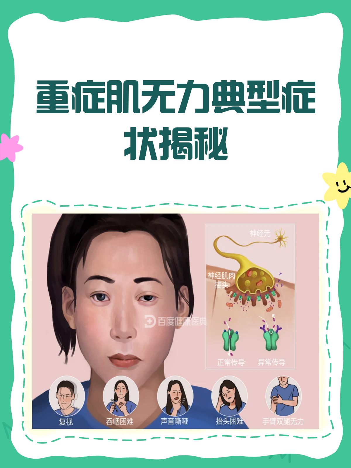 肌营养不良症的症状