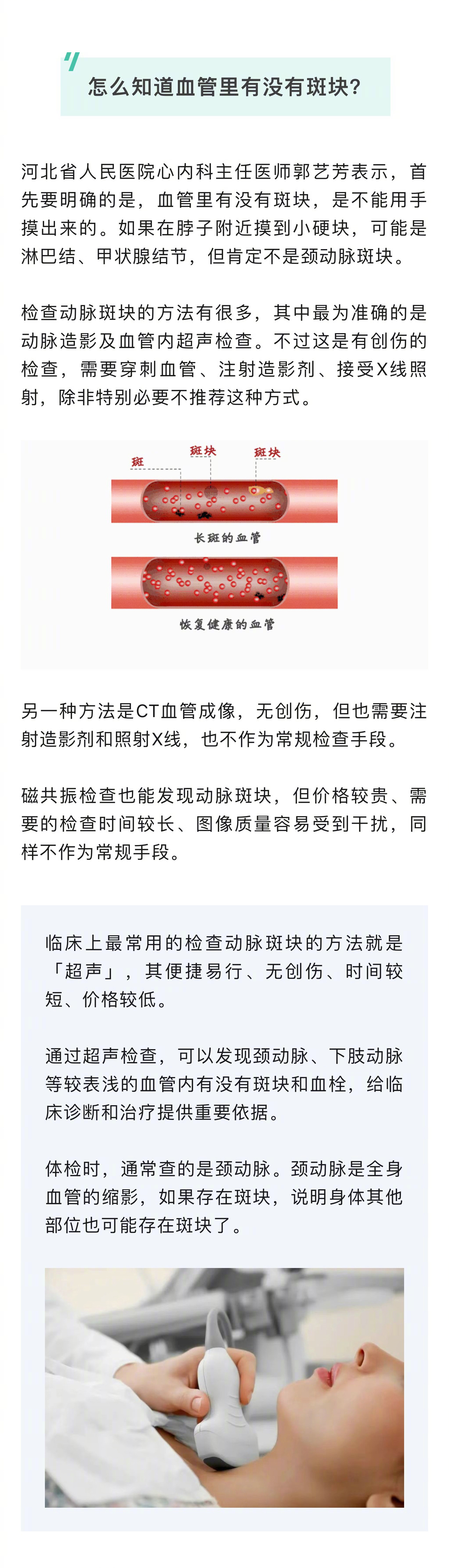 CTA检查有危害吗