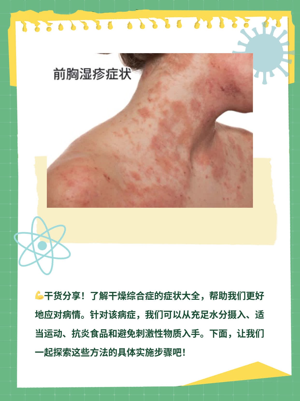 干燥综合征能治愈吗?