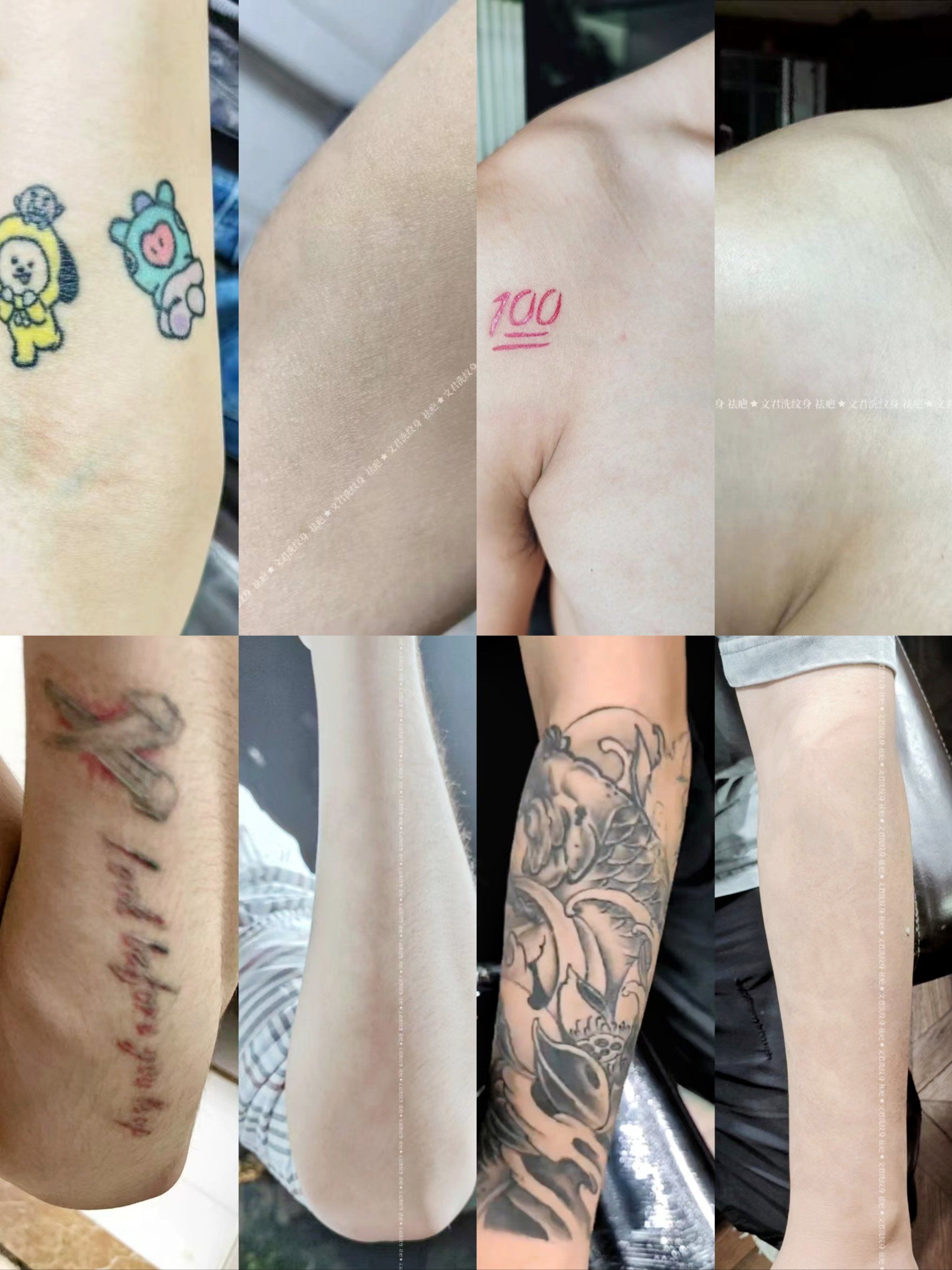 洗纹身后可以当兵吗?