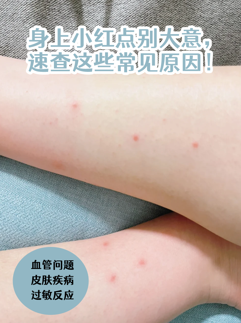 身上起红疹子是怎么回事