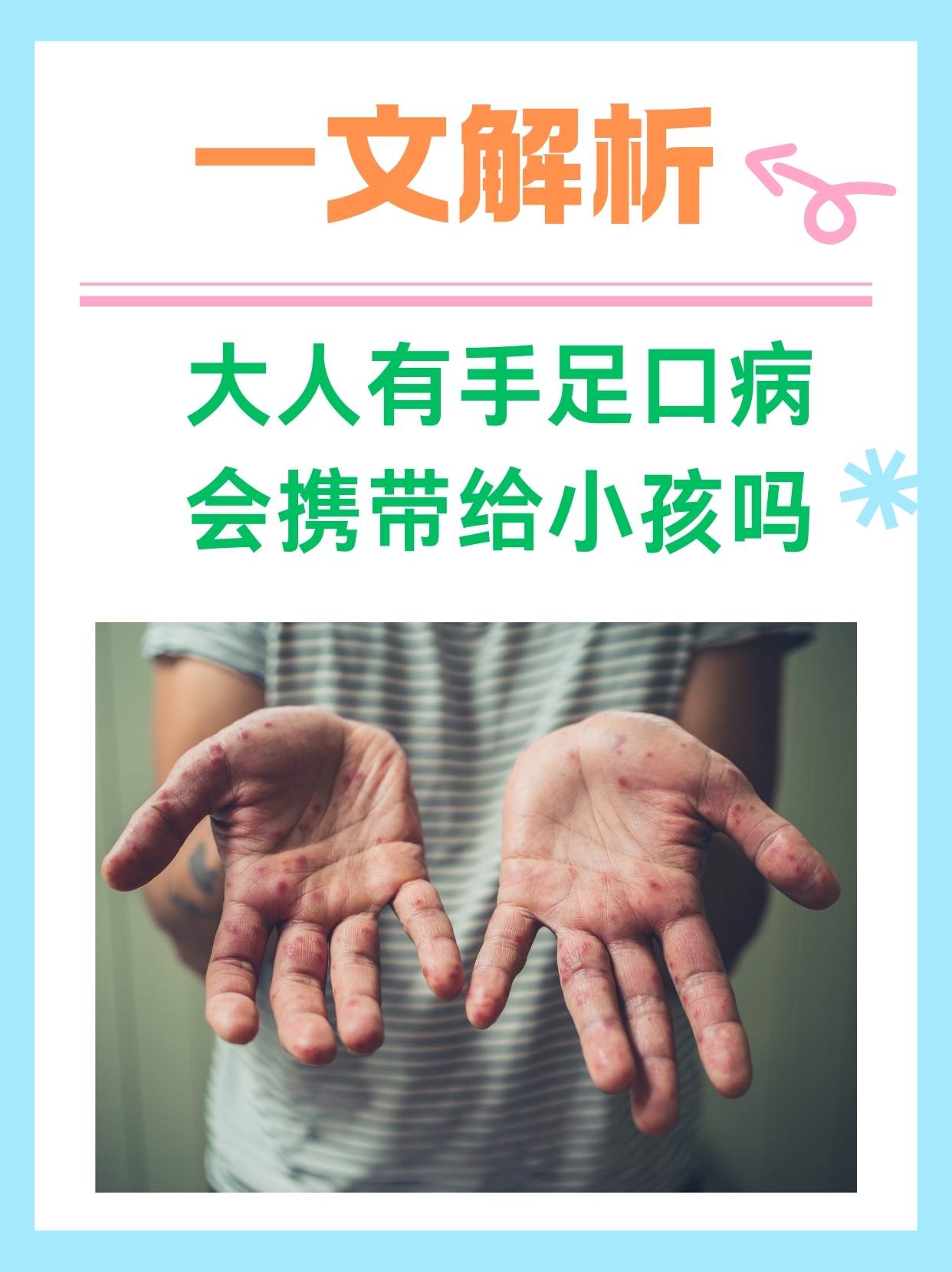 手足口病的传染源主要是什么