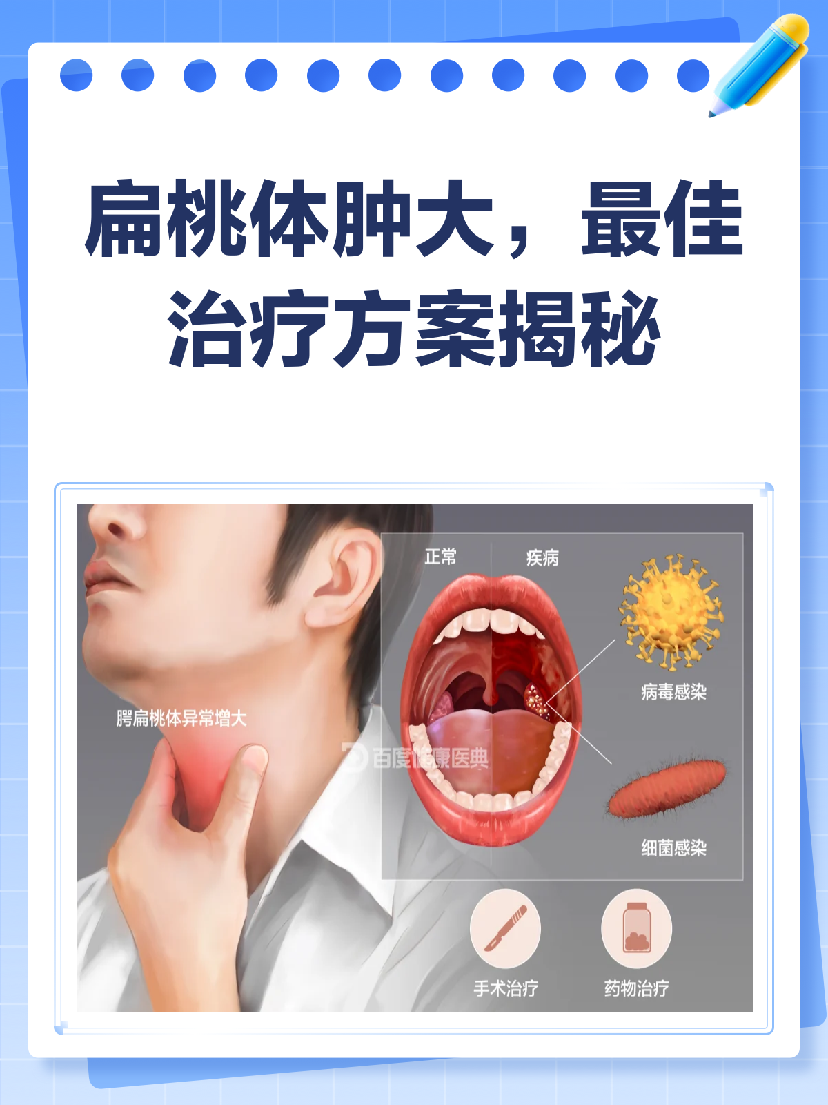 慢性扁桃体炎是什么病