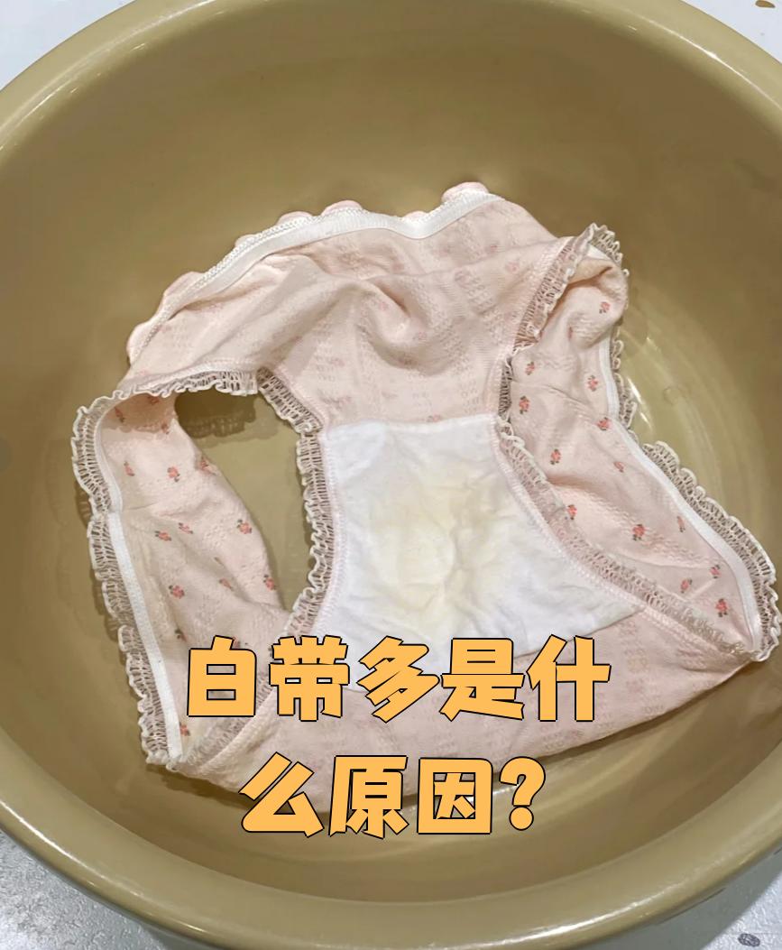 白带多,异味重