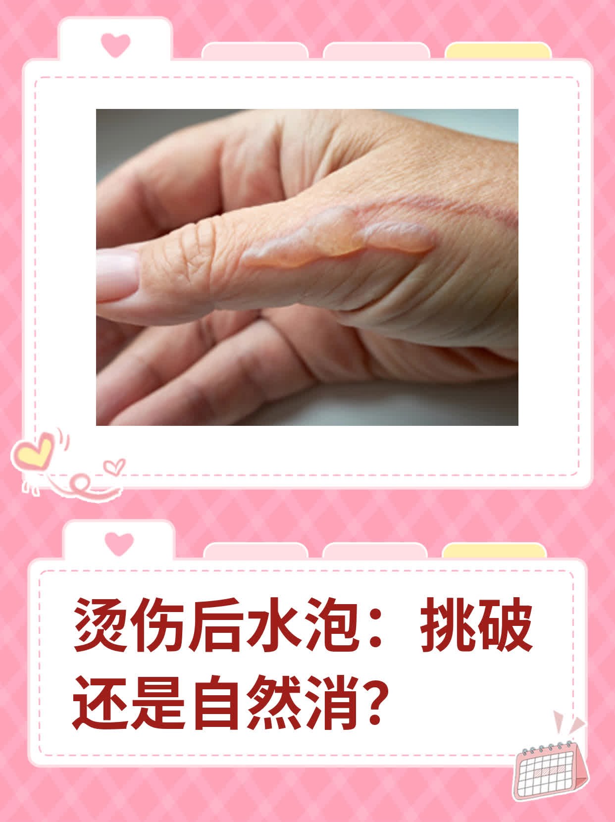 被蒸汽水烫伤怎么办