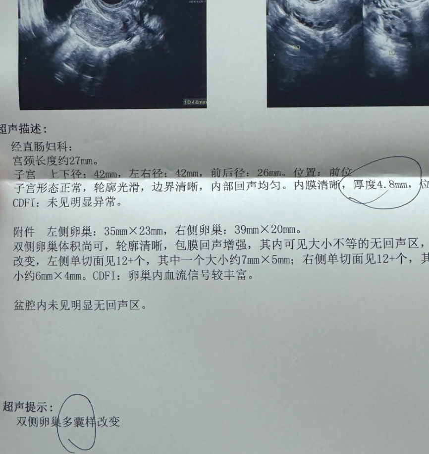 月经推迟二十几天,没怀孕