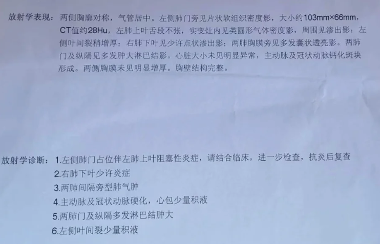 胸部ct能查出什么