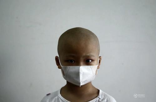 儿童血液病早期症状特点