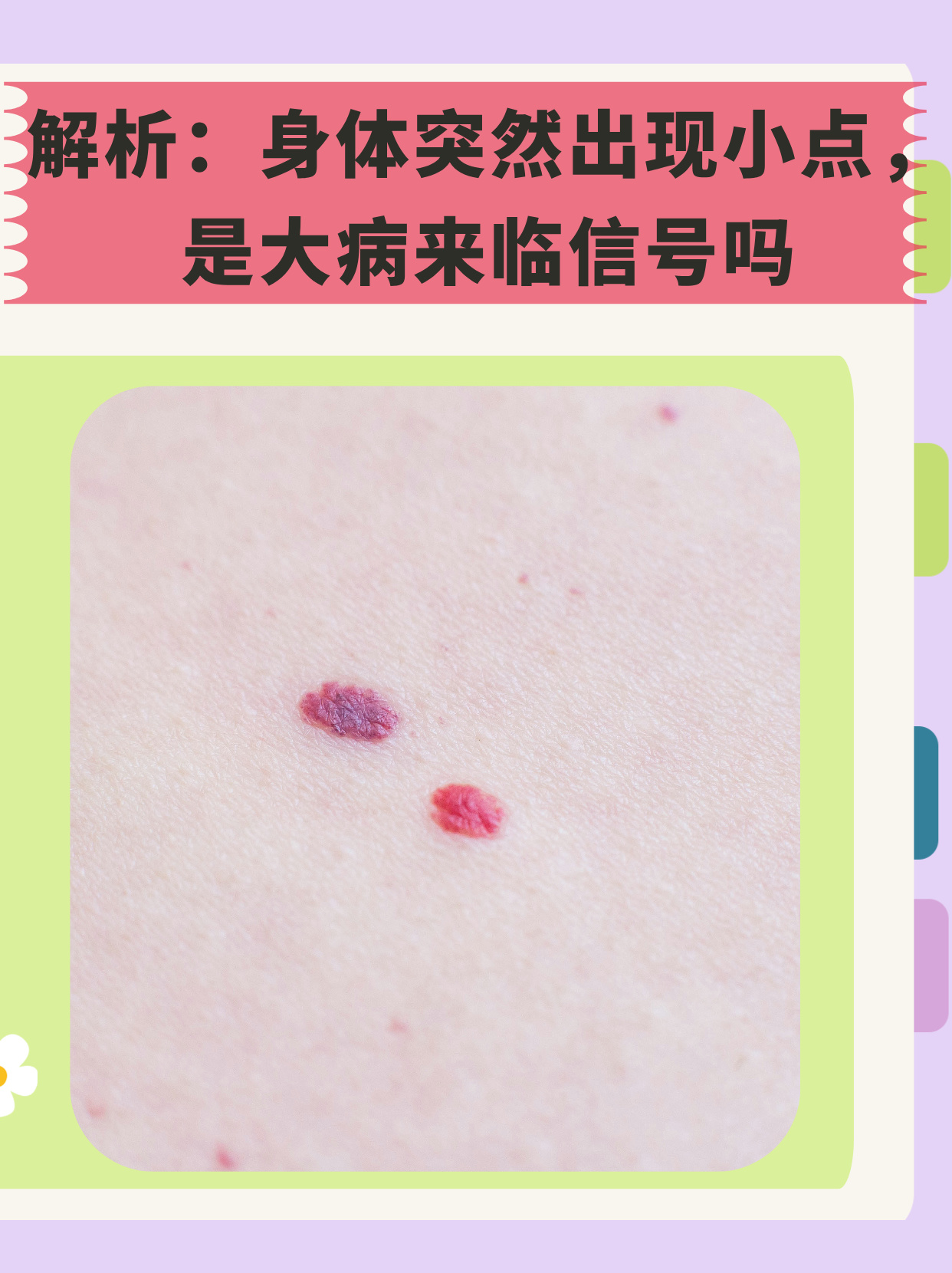 儿童血液病早期症状特点