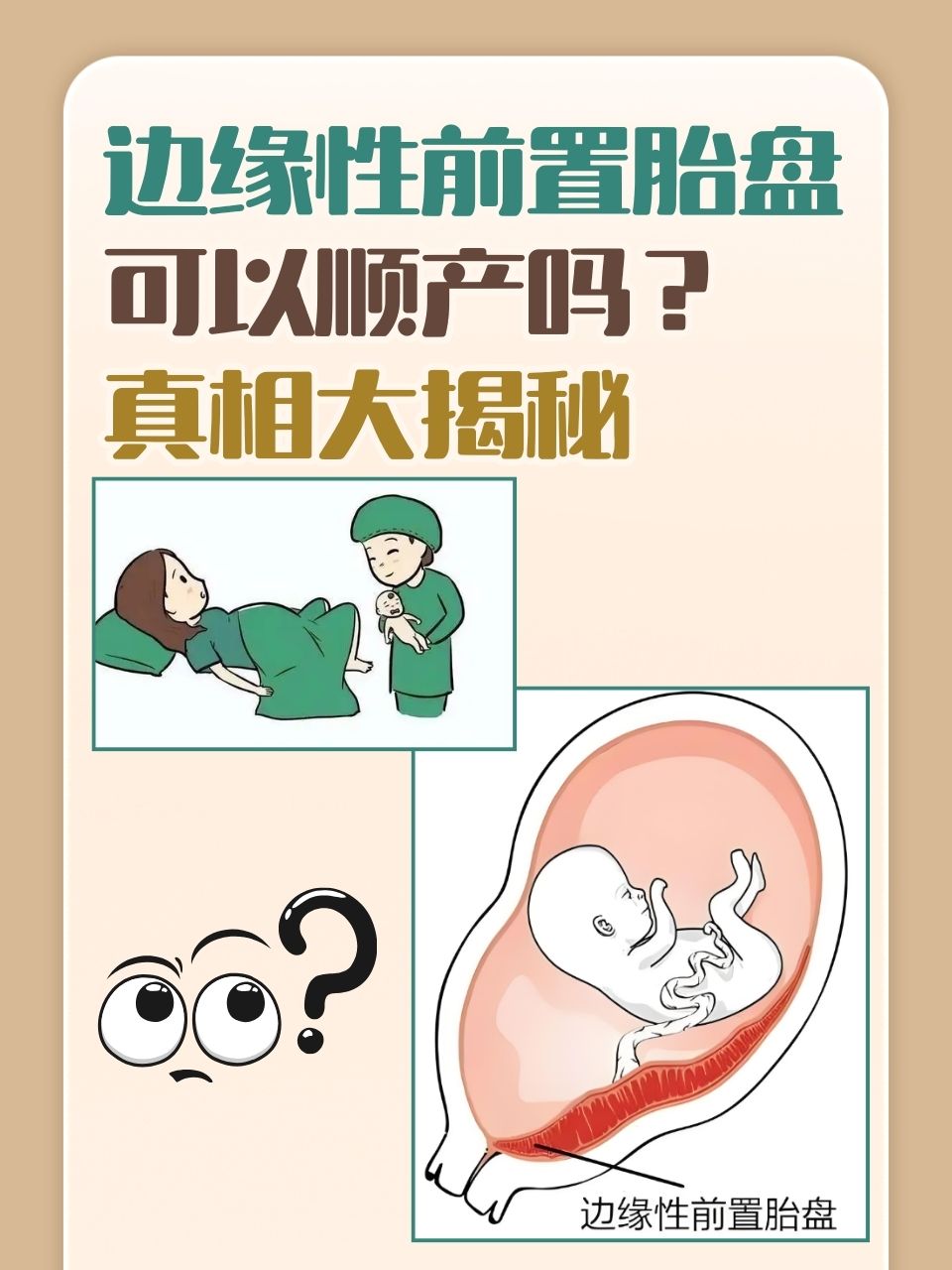 中央性前置胎盘是什么意思