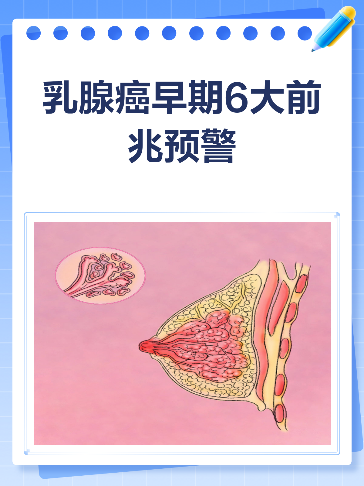 乳腺纤维瘤癌变之前的征兆是什么?