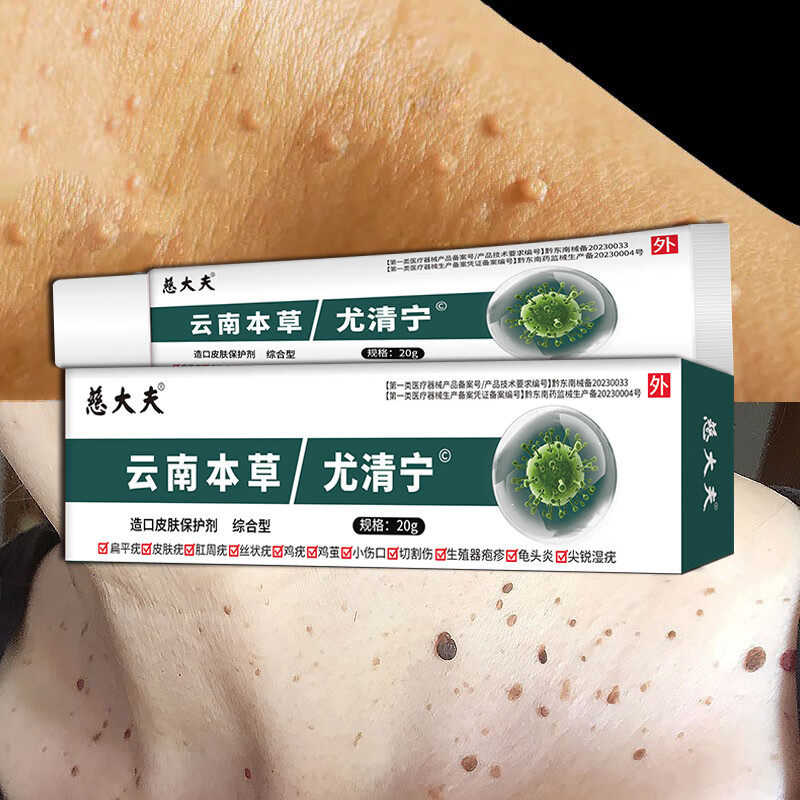 怎么减掉脖子上的赘肉