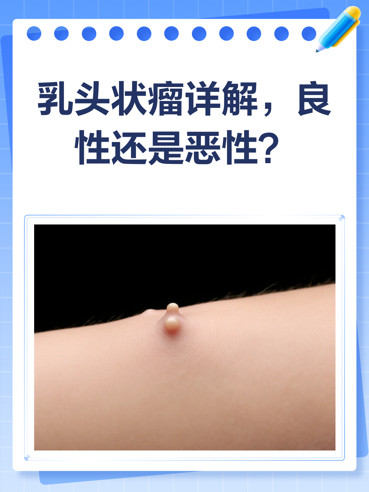 乳房肿瘤的常见症状有哪些?