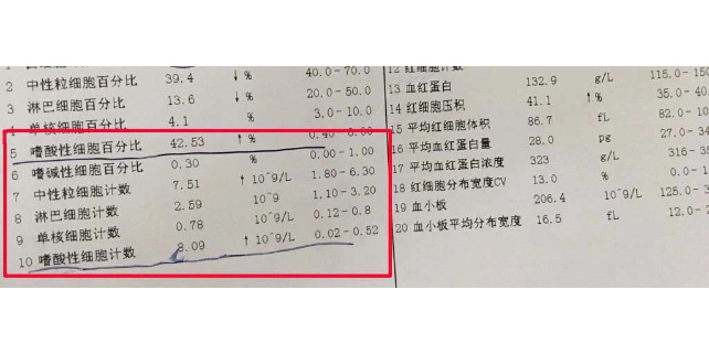 嗜酸性粒细胞百分比偏高