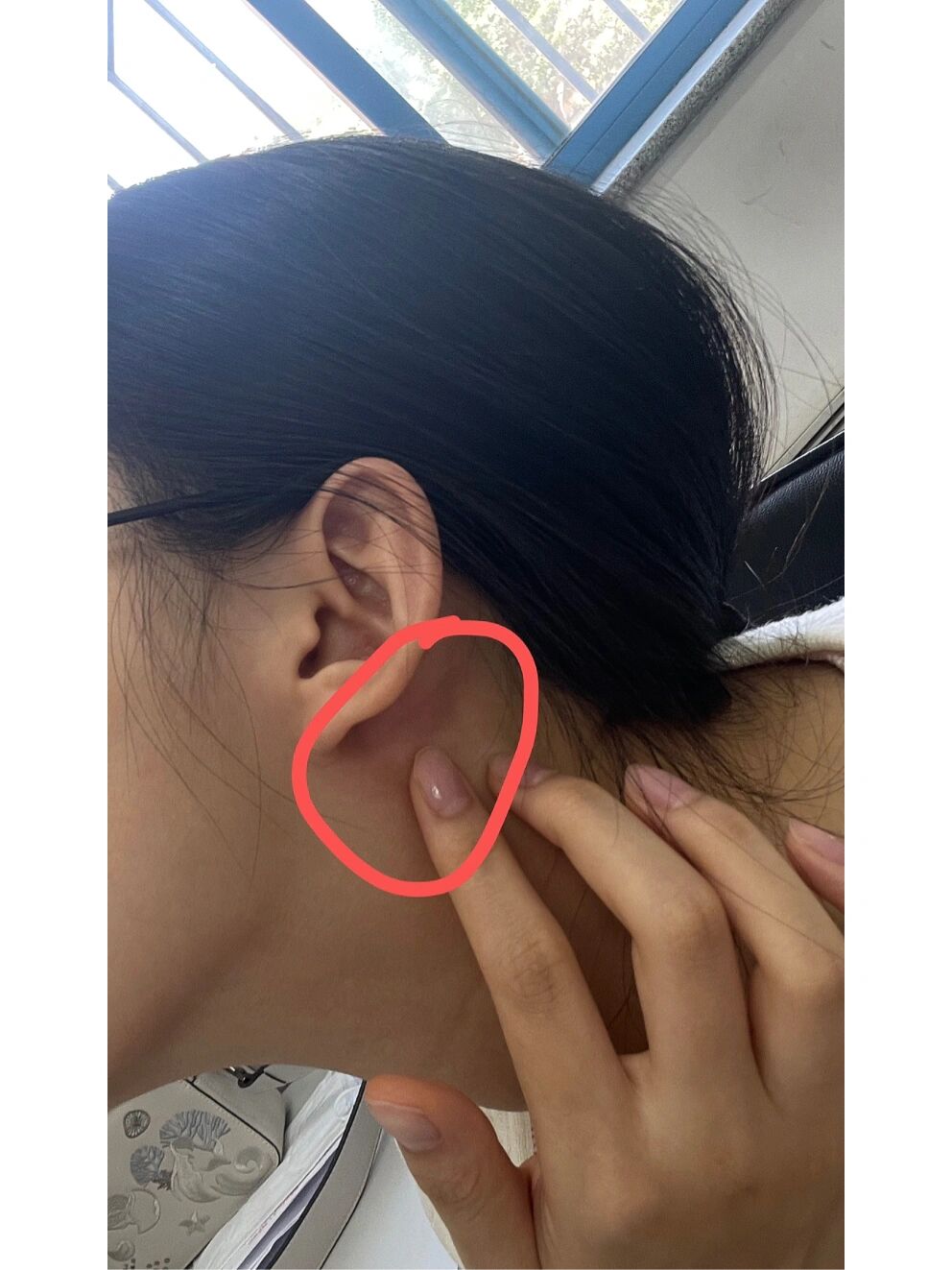 耳朵后面有疙瘩,是不是艾滋病