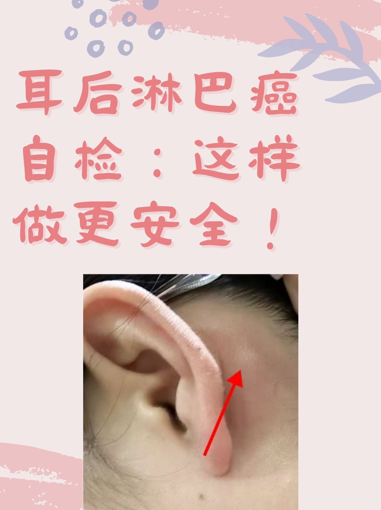 耳朵后面有疙瘩,是不是艾滋病