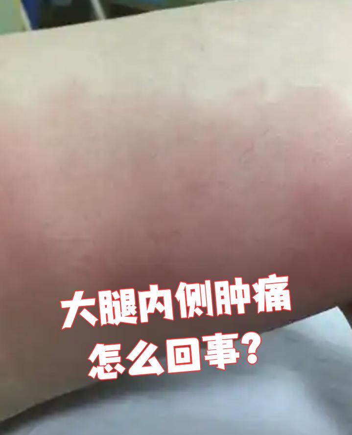 大腿内侧疼痛怎么回事?