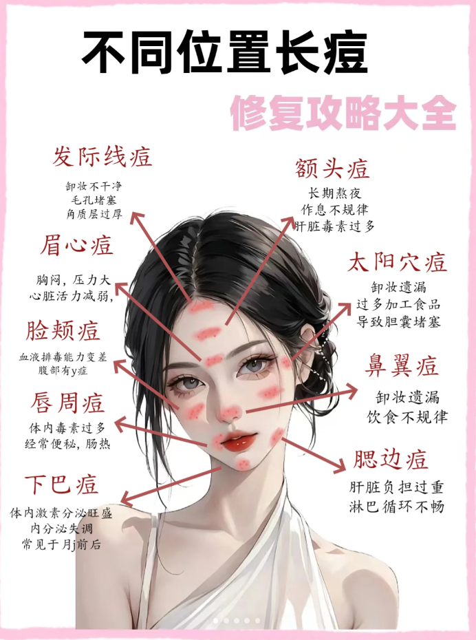 人中附近长痘痘是什么原因